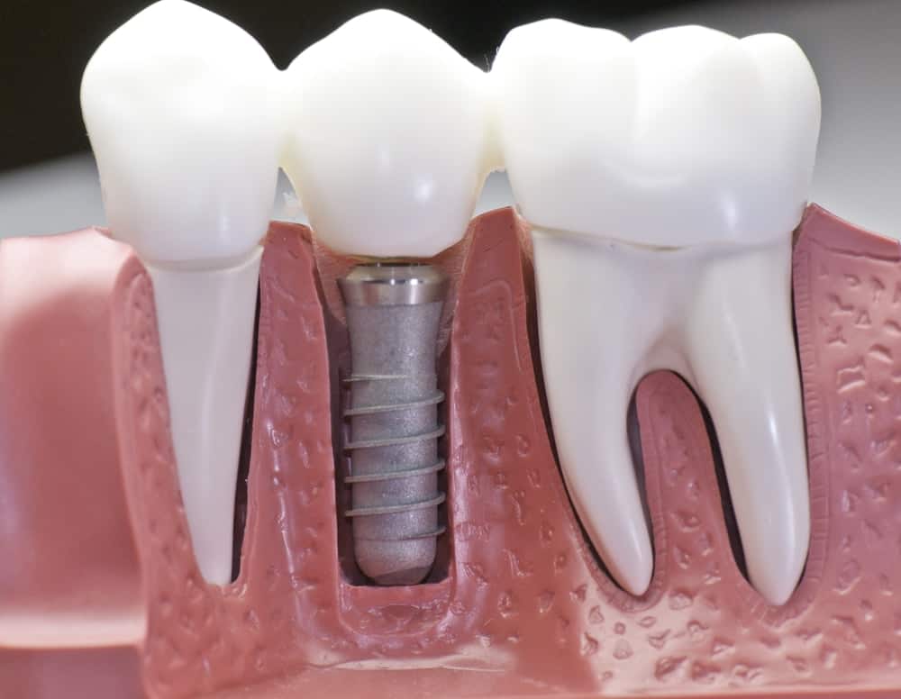 Common Misconceptions About Modern Dental Treatments Bedford