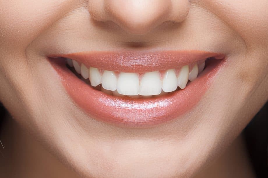 The Impact of White Spots on Oral Health Bedford