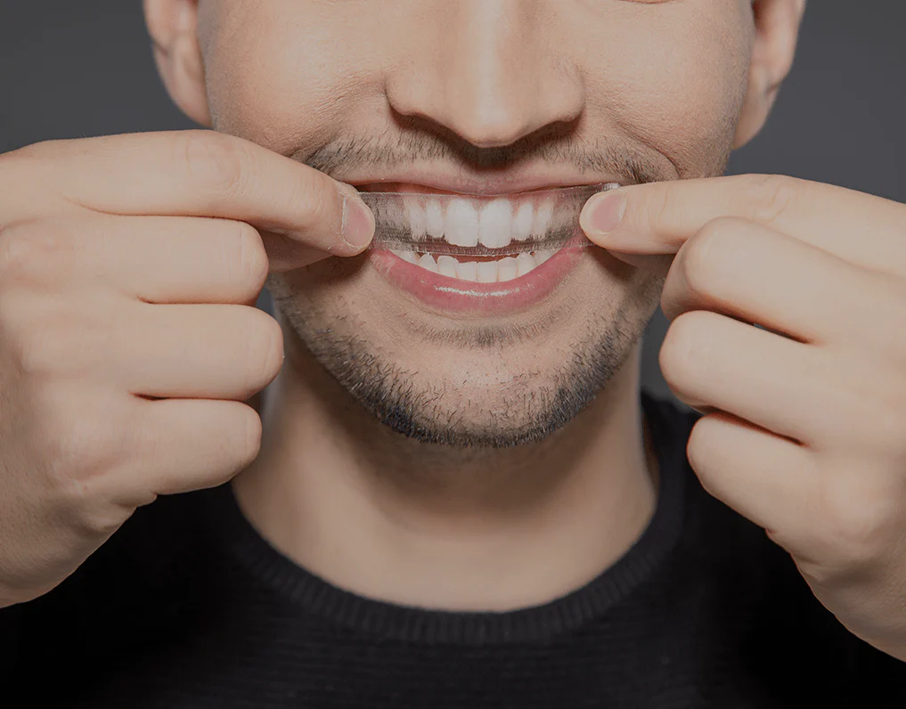 Can You Whiten Natural Teeth Without Harsh Chemicals Bedford?