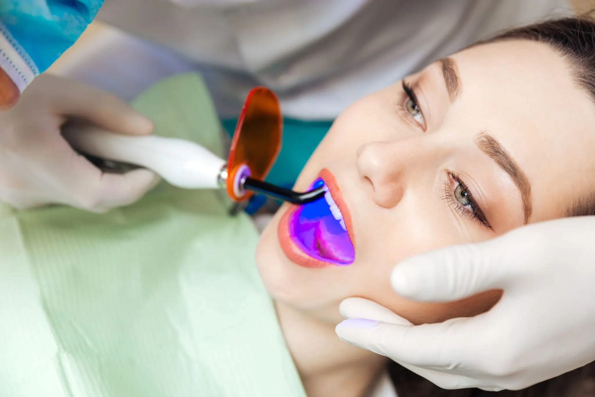 How Long Can You Expect Laser Teeth Whitening Results to Last Bedford?