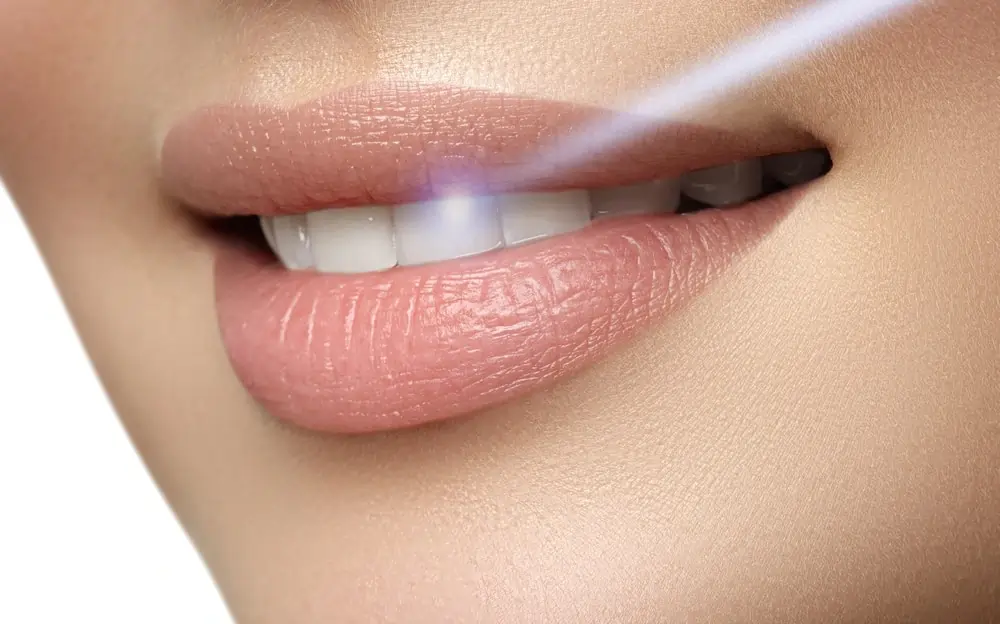 What Are Simple Ways to Improve the Look of Your Smile Bedford?