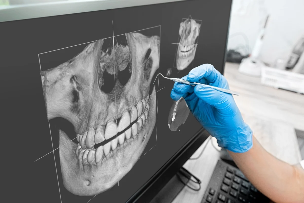 Key Benefits of 3D Printing for Patients and Dentists Bedford