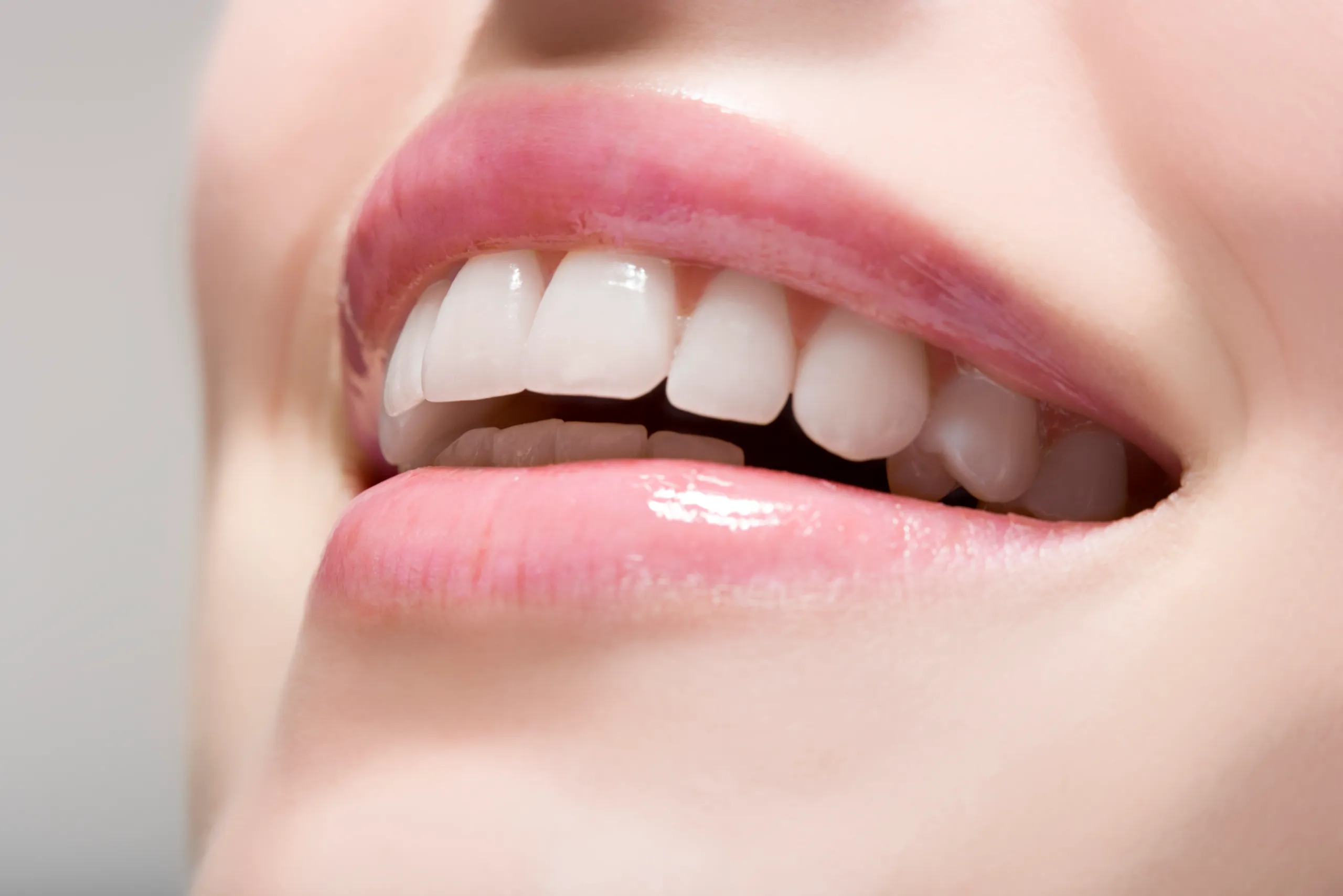 Myths and Misconceptions About White Spots Bedford