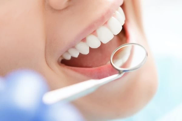 Preventing White Spots on Teeth Bedford