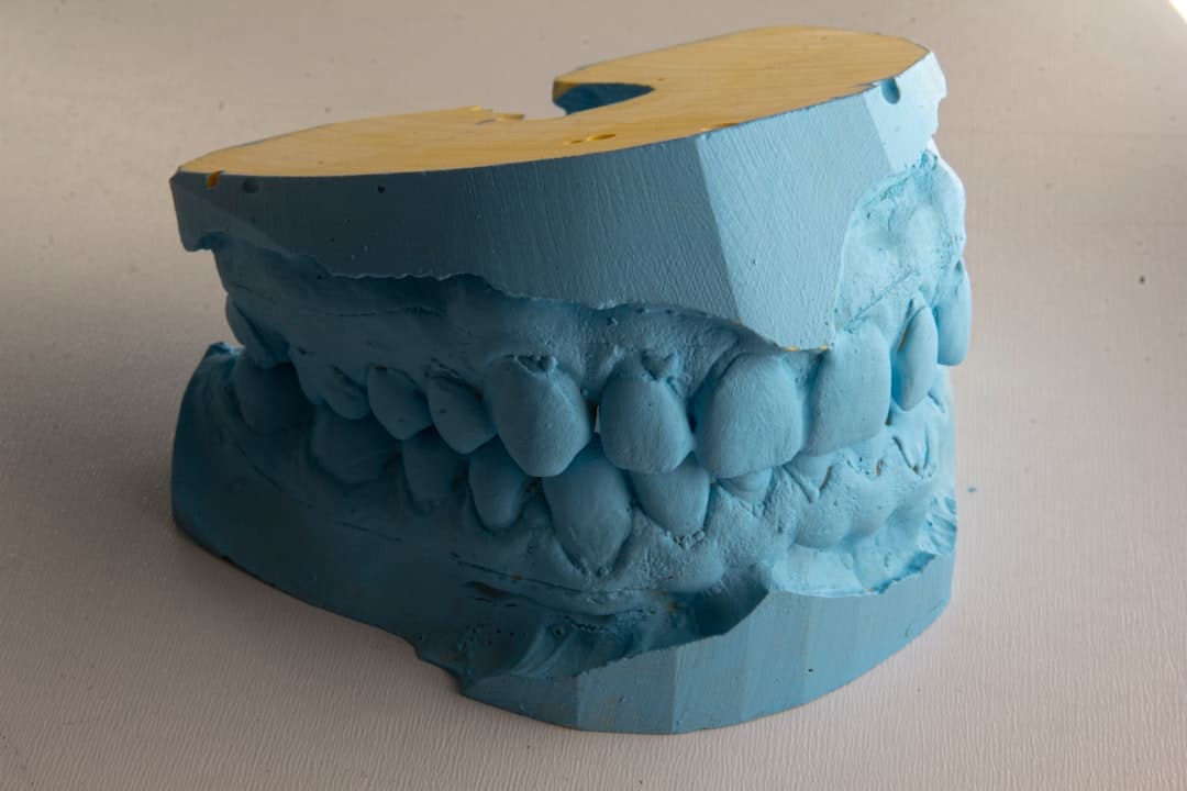 How Do Dental Implants Improve Jawbone Health and Oral Function Bedford?