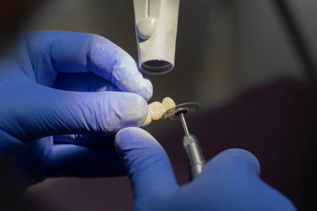 Customised Dental Solutions: Crowns, Aligners, and Implants Bedford